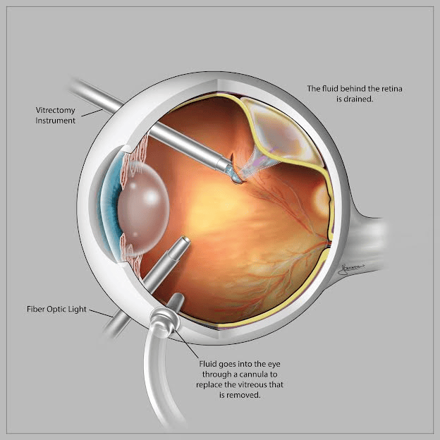 Drishtipath Eye Hospital