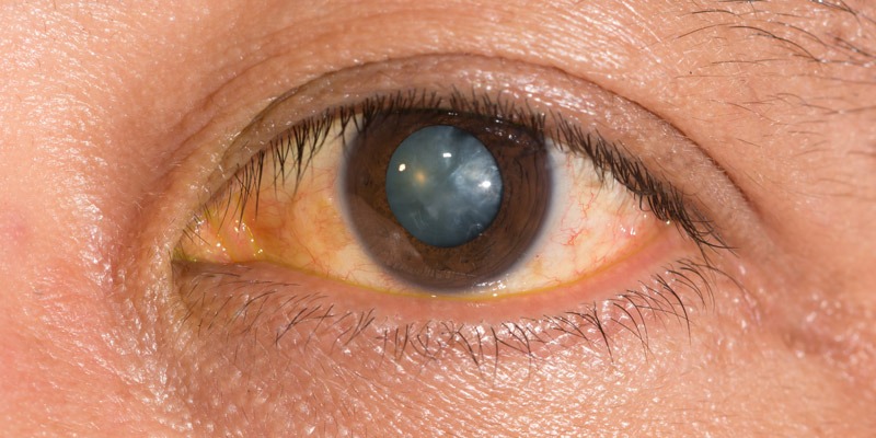 Drishtipath Eye Hospital