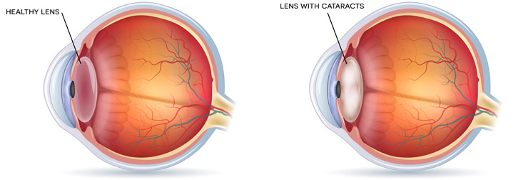 Drishtipath Eye Hospital