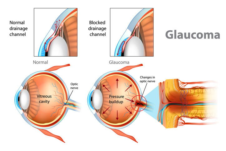 Drishtipath Eye Hospital
