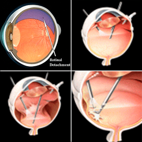Drishtipath Eye Hospital